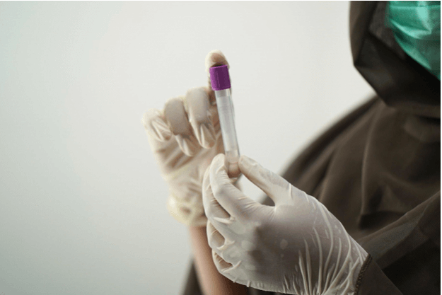 Who Can Get a Covid-19 Antibody Test