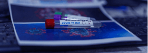 Molecular Assay Based Covid-19 Test 